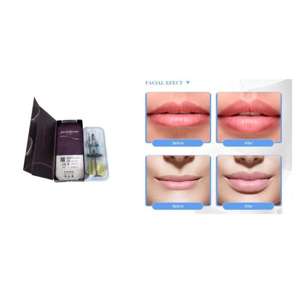 Allergan Juvederm 1ml*2 Hyaluronic Acid Fillers Nose Voluma With Lidocaine