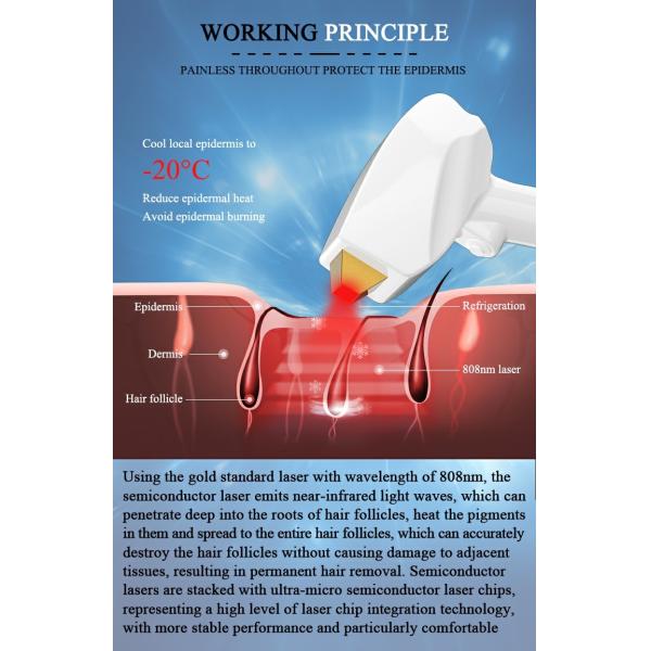 1~10Hz Frequency Hair Removal Machine 2 Year Maintenance Diode Laser 260J/CM2