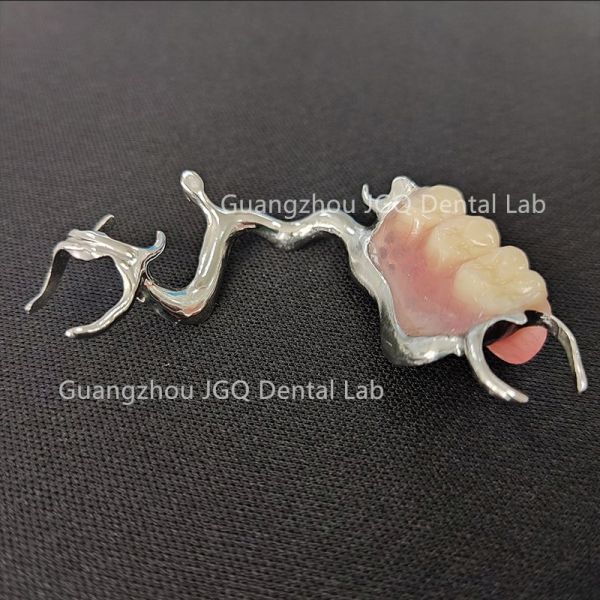 Lightweight Dental Framework Partial Dentures 3D Laser Printing Comfortable