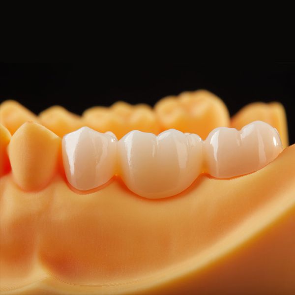 China Zircon Multilayer Zirconia Block for CAD CAM Dental Restorations
