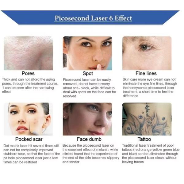 Machine d'élimination de tatouage au carbone, machine de beauté à peeling, équipement de peau laser picoseconde Nd Yag Pico pour le blanchiment de la peau