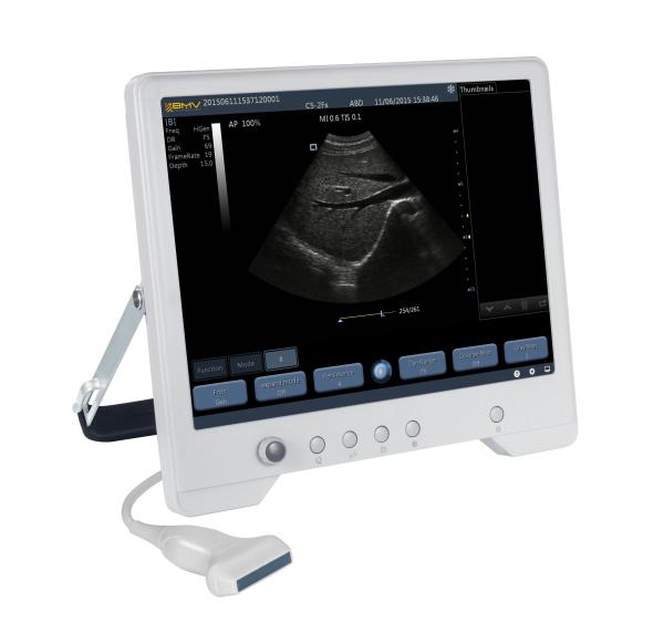 TS20 Digital Diagnostic Ultrasound System for Obstetrics and Gynecology Department