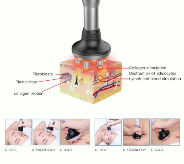 OEM Private Label Portable Ultra Slimming Device EMS RF Photon Led Light Therapy Home Beauty Device