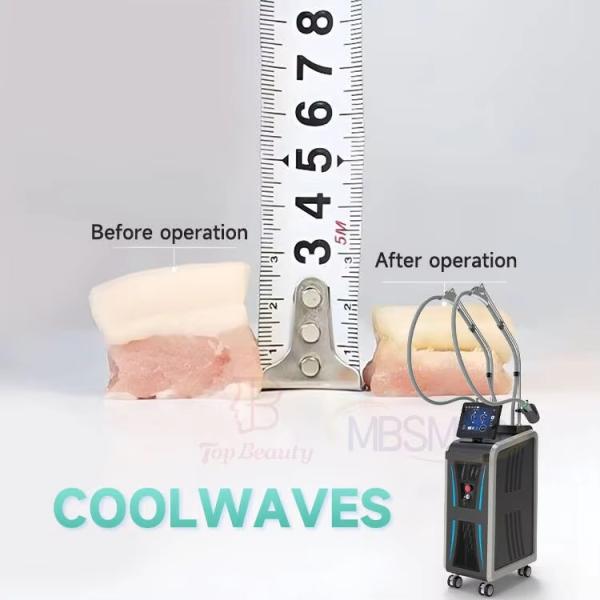 3 Handle Big Screen Onda Pro Coolwave Body Forming Face Lifting Machine 2.45ghz Onda Pro Coolwave Device