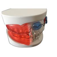Les appareils orthodontiques dentaires simples installent le matériel biologique de technologie