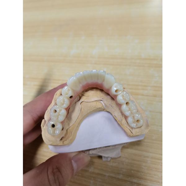 Consistência em cada coroa nosso processo de manufatura da coroa do implante