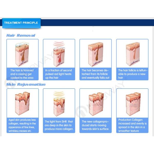 Factory price semiconductor + water + air super strong cooling system ipl hair removal machine