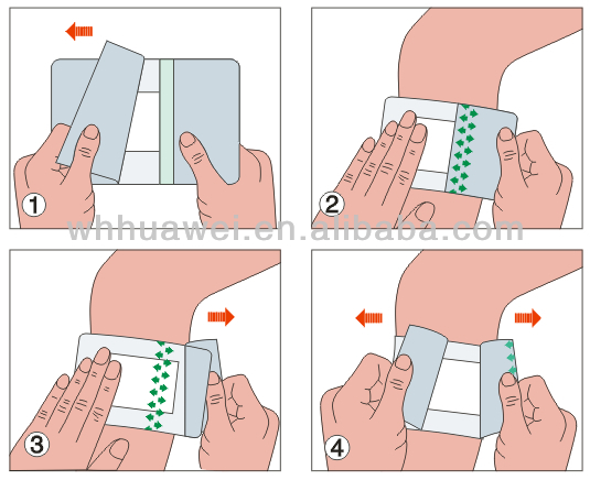 Medical Care Wound Adhesive Stick Plaster CE,ISO 13485 certificate transparent wound film dressing