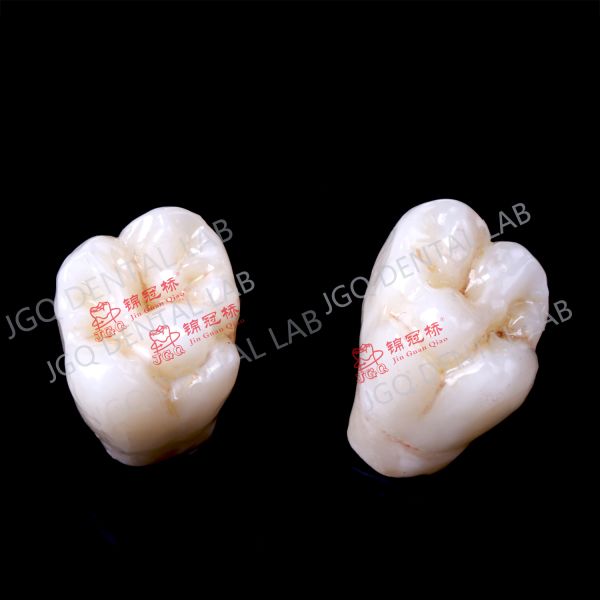 OEM Zirconia Crown Dentures China Dental Lab Outsourcing CE FDA Certified