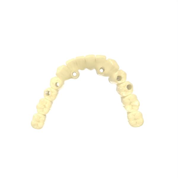 Biocompatible Material Photosensitive Resin 3d Printing For Temporary Crown And Bridge