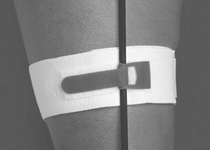 Lightweight Foley Catheter Straps Polyester Rubber Material Medical Consumables