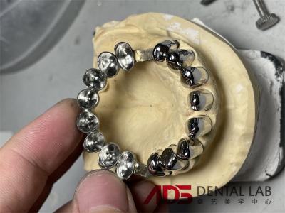 Metal Cylindrical Precision Attachment Denture Telescoper Crown For Dental Prosthesis