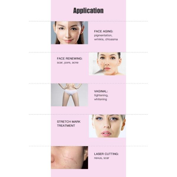 Частичный лазер СО2 подвергает волшебный ИМП ульс механической обработке для удаления шрама, затягивать кожи