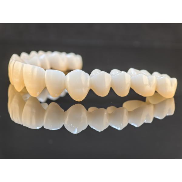 High Translucency Full Contour Zirconia Bridge