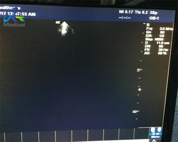 GE 3SP Ultrasound Transducer Probe Cardiac Sector Medical Apparatus