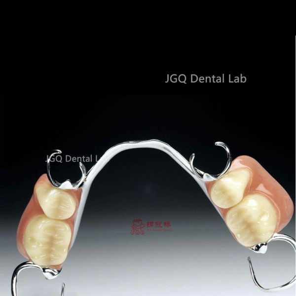 3D Laser Printing Removable Dentures Customized with Co-Cr Alloy Framework