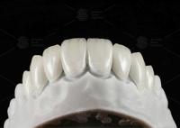 Faisceau de dentition EMAX pressé naturel 16 nuances