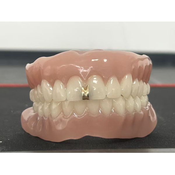Custom Full Denture with Natural Appearance and Comfortable Fit for Complete Arch Restoration