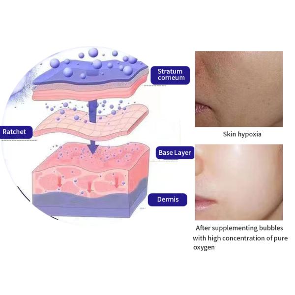 Skin Tightening Wrinkle Removal 100v Multifunction Beauty Machine For Salon Massage