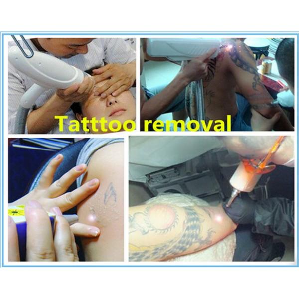 Portable 3 Million Shots Nd Yag Laser Tattoo Removal Machine For Home Use