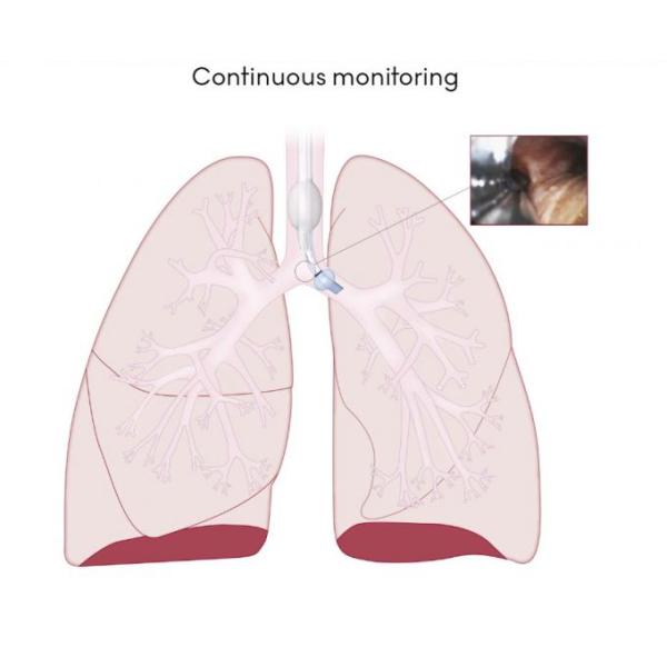Мягкий PVC визуальный двойной люмен и эндотрахеальная трубка для хирургической анестезии
