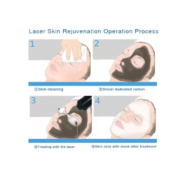 Машина удаления татуировки лазера Pico обработки кожи, лазер ND YAG переключателя 2000W q