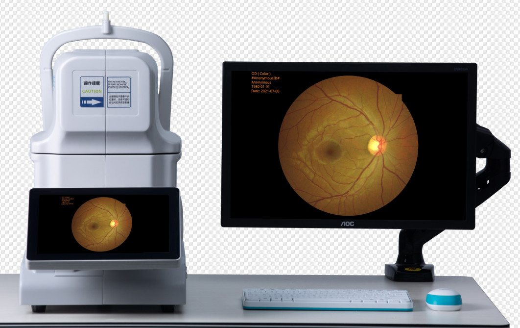 Один ключ нажимает на не Mydriatic изображение камеры 3264×2488 Fundus мини приобрел автоматически