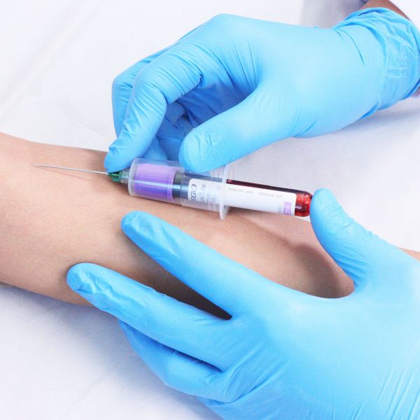 Vacuum EDTA Blood Tubes for Complete Blood Count (CBC) – High Quality, Secure Seal
