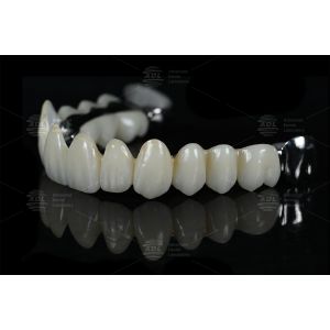 China Dental Lab Outsource Dental Lab Ti Reinforcement Bar With Full Zirconia
