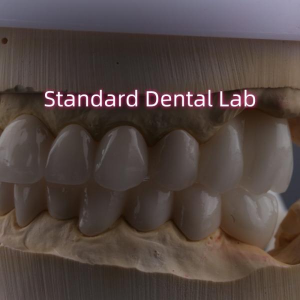 Laboratorio dental Arco completo de zirconia Coronas de porcelana PFZ Corona ISO FDA CE