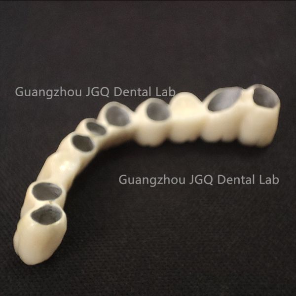 China Dental Lab Fabricated Dental Pfm Bridge Teeth Fast Fitting Customized