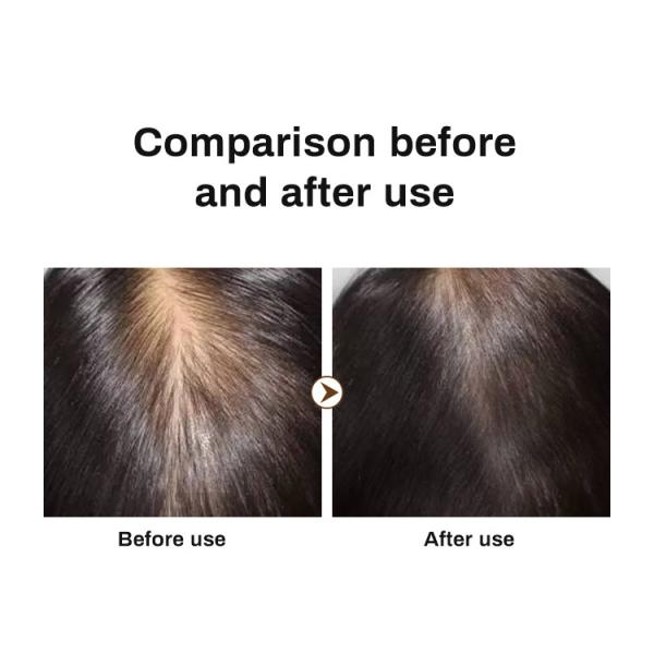 Best Selling Hair Growth Shampoo for Thinning Hair Loss for Women and Men Thicker Longer Hair