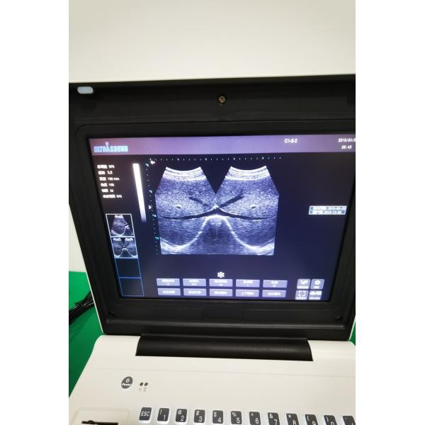 Hospital Outside Diagnostic Linear Ultrasound Machine Dog Ultrasound Machine Laptop Cow Pregnancy Sheep Scanner