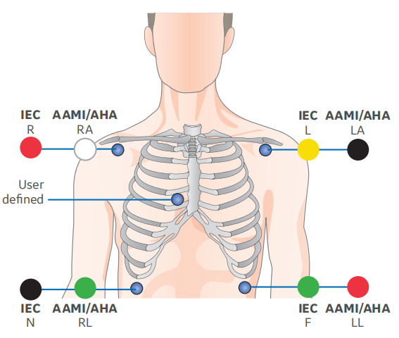 2106391-001 Сгруппированный набор отведений ЭКГ 5 Захват отведений AHA 74 см 29 дюймов 412681-001 414556-001