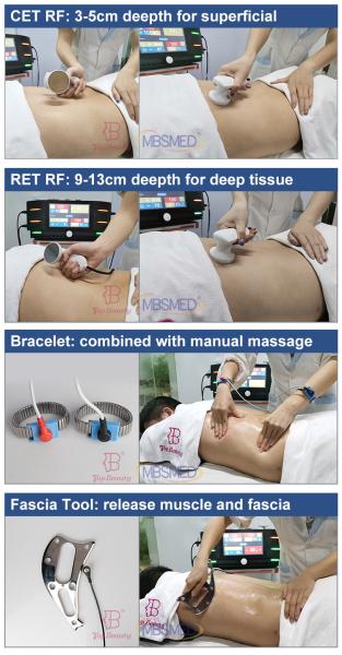 Appareil de beauté de thérapie physique CET RET RET CET 448khz Indiba Tecar physiothérapie