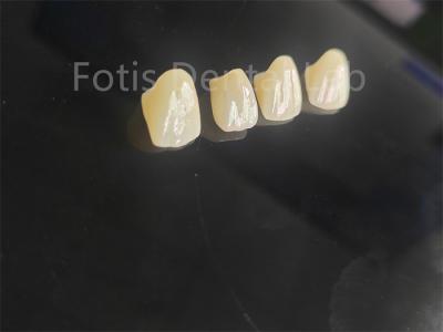 Professional Grade Porcelain Fused Zirconia For Perfectly Fitting Dental Restorations