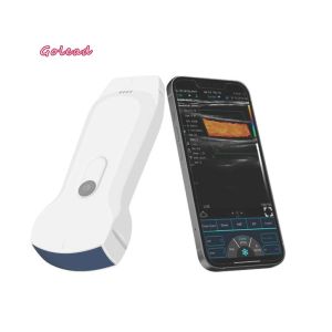 Wireless Ultrasound Probe