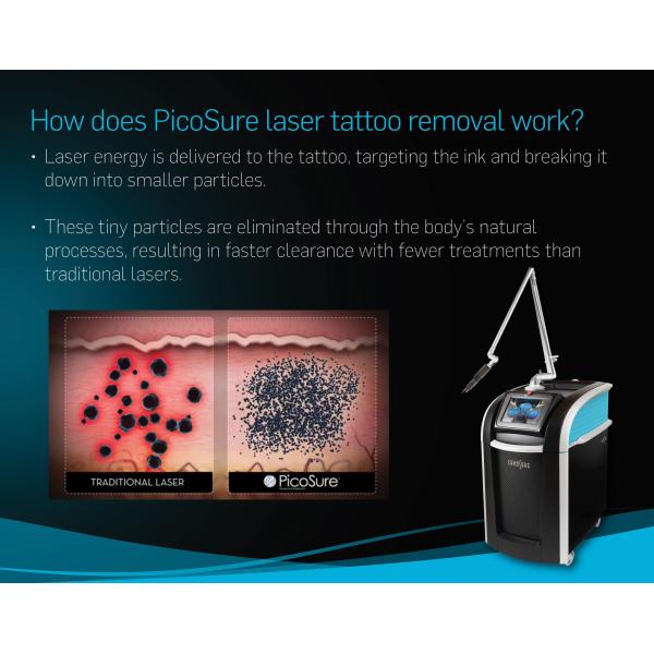 Q Switch ND YAG удаление пятен удаление пигмента удаление пикосекундных лазерных татуировок 532/755/1064nm