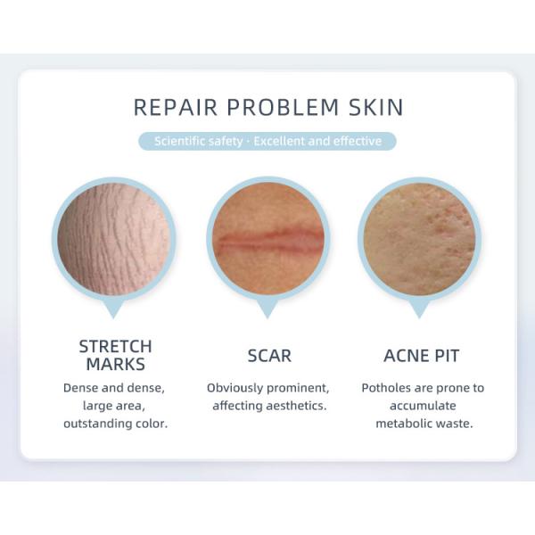 Воздушное охлаждение воды машины лазера СО2 Fotona 4d 10600nm частичное