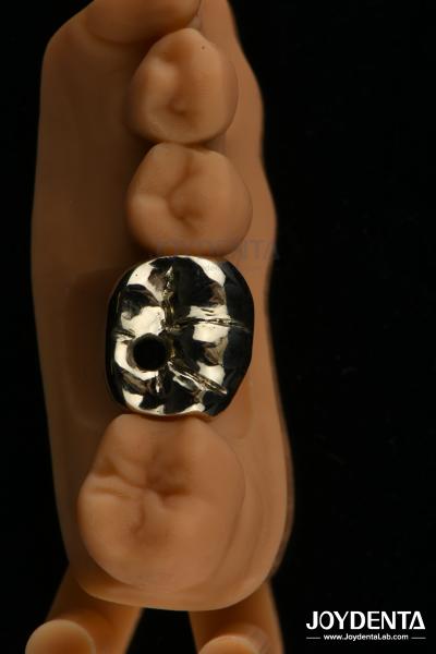 Oral Rehabilitation Wax Casting FMC Full Metal Crown For Dental Clinical Repair