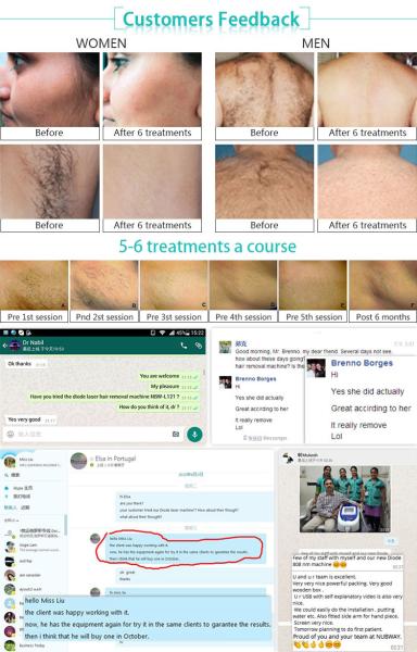 808 nm diode laser hair removal machine for spa/clinic/salon use permanent,painless hair remove