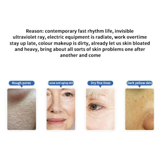 Small Size Hydrafacial Machine / Water Diamond Dermabrasion Aqua Facial Machine