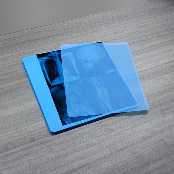 Фильм 330mmx432mm цифров x Рэй фильма низкого дюйма тумана 13x17 медицинский сухой