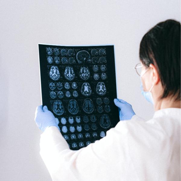 Radiografía seca baja azul médica X Ray Films 8x10inch 14x17inch de la niebla de Fuji Diht del chorro de tinta bajo médico del animal doméstico