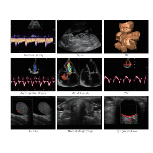 S20 Sonoscape Ultrasound Sonoscape Ultrasound s2 Ultrasound Scanner Sonoscape
