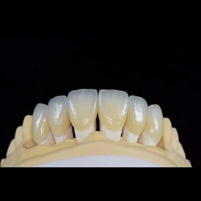 Dental Lab Teeth Feldspathic Porcelain Veneers Custom Shaped