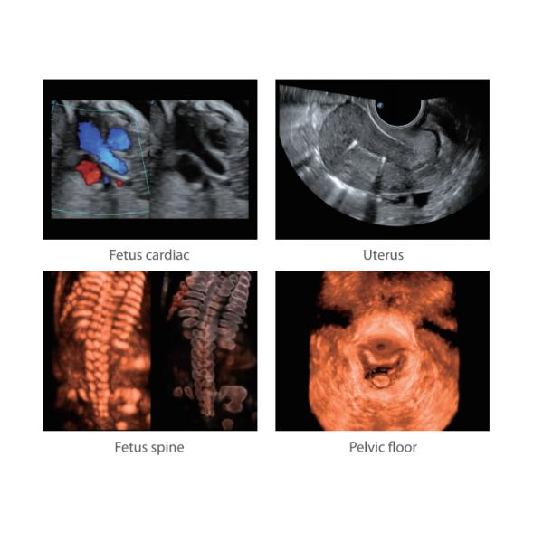 Cardiovascular Sonoscape P50 Ultrasonido Doppler Ultrasound Machine