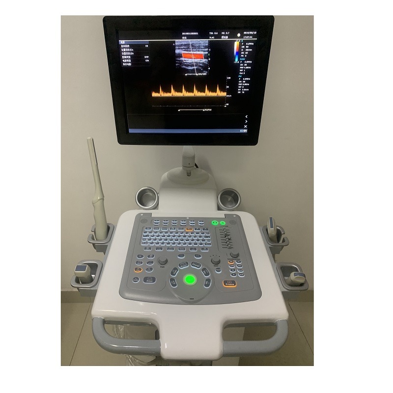 Hospital Outside Trolley 15Inch Ultrasound Machine Ultrasound Digital Color Doppler Ultrasound Machines edical