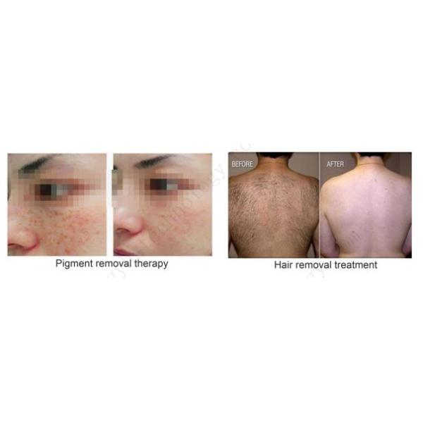 Double Handpiece Professional Ipl Laser Hair Removal Machines 110v - 240v