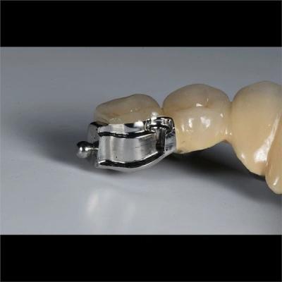 Aesthetic Precision Dental Implant Ball Attachment Partial Dentures